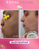 پک صابون و کرم رویال اصل اصل بشرط تضمین درجه یک