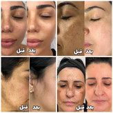 کرم ضد لک بیوممتیک ایتالیایی اصل بشرط بارکد اورجینال آف ویژه تا پنجشنبه